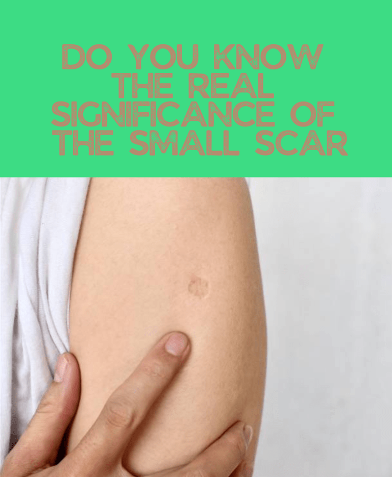 Do You Know The Real Significance Of The Small Scar