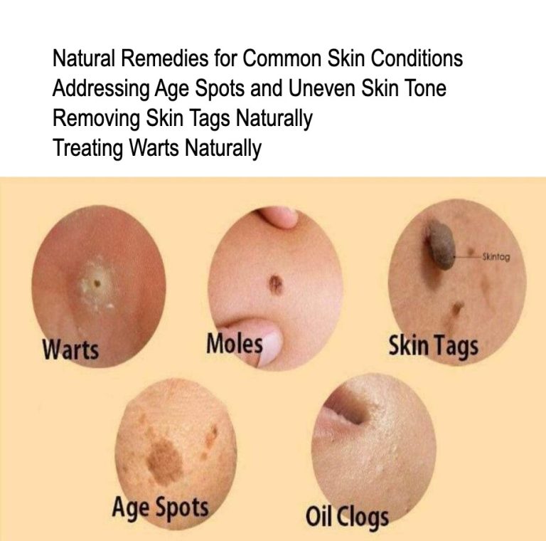 Natural Remedies for Common Skin Conditions